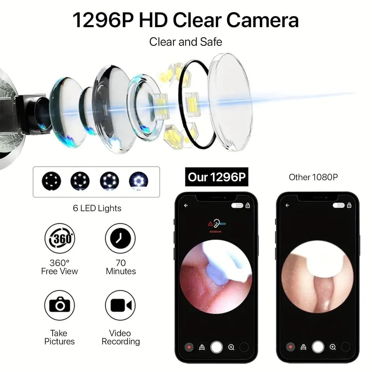 Smart Visual Ear Wax Cleaner with 8 MP HD Wi-Fi Camera